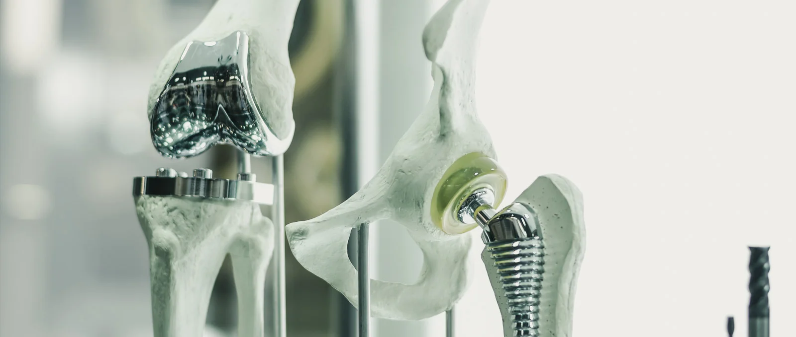 The iMPACT-Implants program